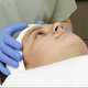 Treating Teen Acne Clients